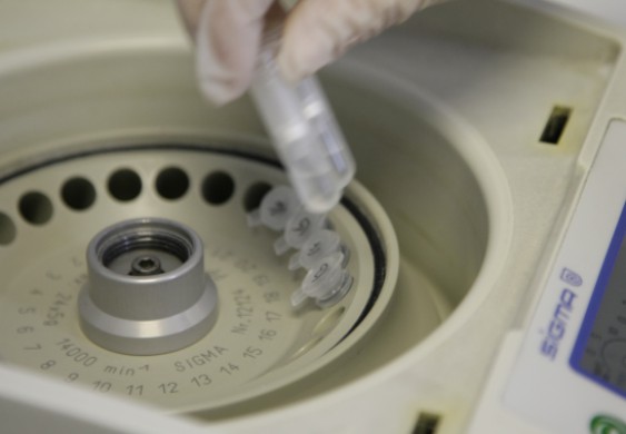 "مطابق للسلالة الطبيعية".. صنع فيروس كورونا في مختبر أوروبي - الحرة