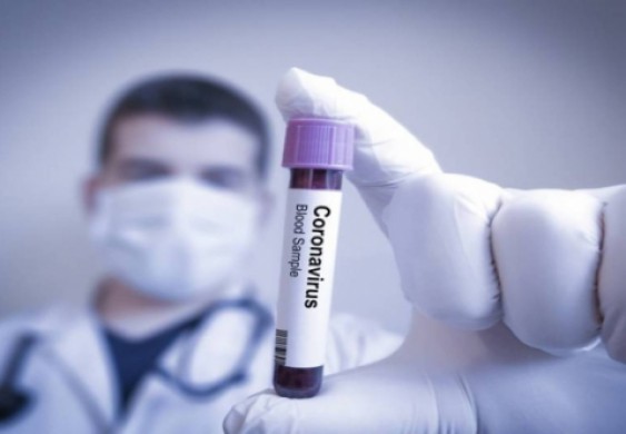 بنغلاديش تنتج عقاراً لعلاج كورونا بـ 65 دولاراً - صحيفة البيان