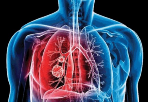 تحذير من 1.5 مليون وفاة.. أمراض أخرى تحصد الأرواح وسط تفشي "كورونا" - سياسة