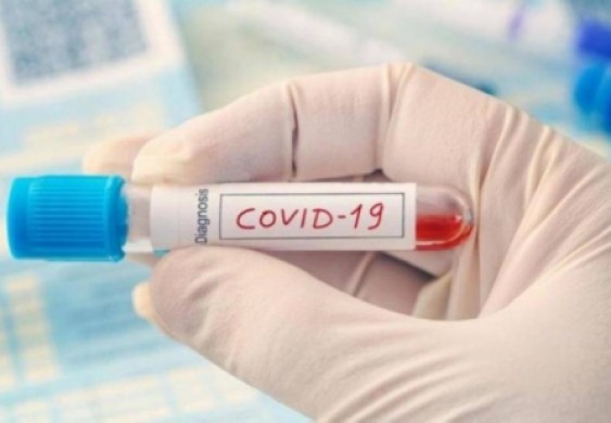 لقاح أمريكي يقضي على كورونا في أربعة أيام