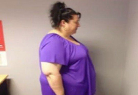 الخوف يفقد سيدة أسترالية نصف وزنها