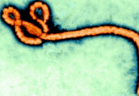 دراسة: مسكن الألم آيبوبروفين قد يبطل مفعول فيروس إيبولا