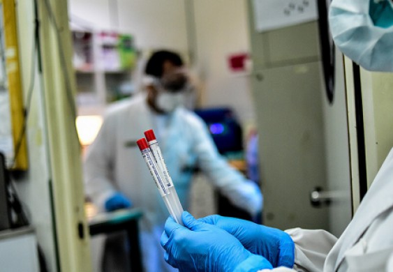 سلالة جديدة أشد عدوى من فيروس كورونا تجتاح العالم وتصعّب تطوير لقاح ضده! - RT Arabic