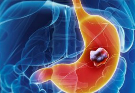 في الصيام.. ابتعد عن تناول هذه الأطعمة على معدة فارغة أبرزها الموز والزبادى - اليوم السابع