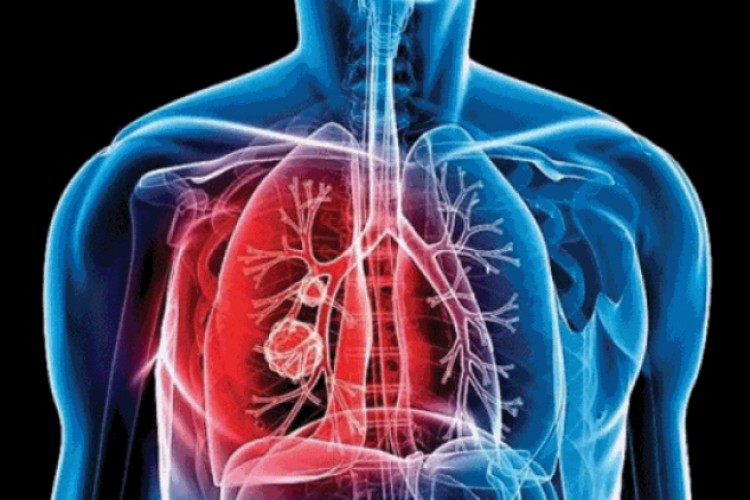 تحذير من 1.5 مليون وفاة.. أمراض أخرى تحصد الأرواح وسط تفشي "كورونا" - سياسة