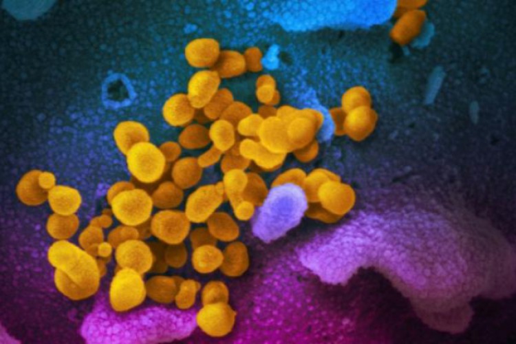 40 عاما على استئصال الجدري.. قتل 300 مليون وهزمه التعاون الدولي - العين الإخبارية | Al-Ain.com