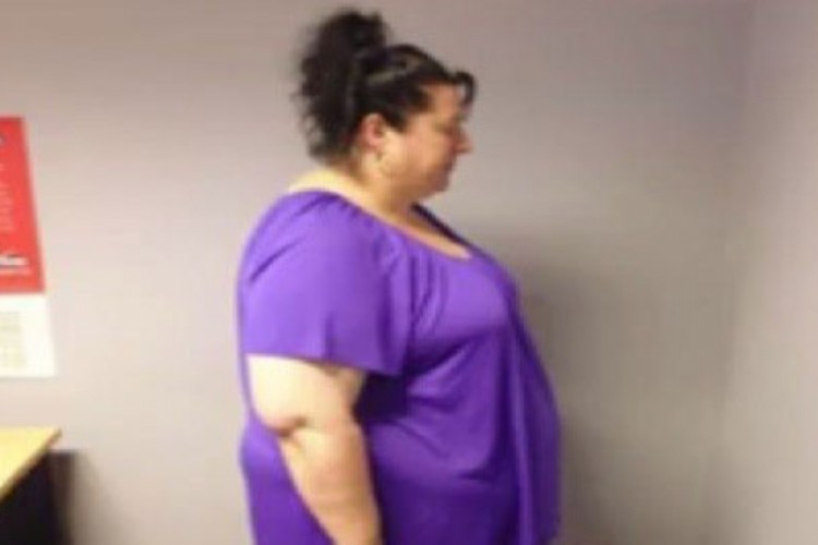 الخوف يفقد سيدة أسترالية نصف وزنها