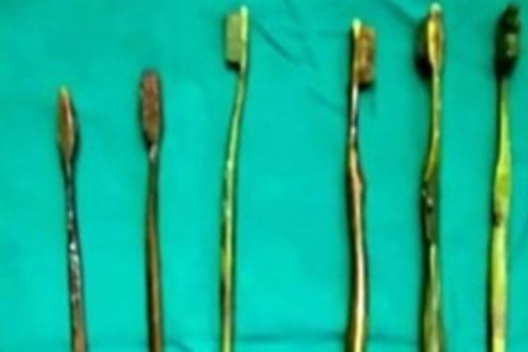 7 فراشي أسنان ابتلعتها فتاة بعد محاولة إجبارها على الزواج