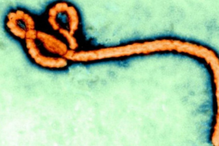 دراسة: مسكن الألم آيبوبروفين قد يبطل مفعول فيروس إيبولا