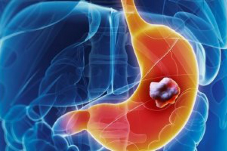 في الصيام.. ابتعد عن تناول هذه الأطعمة على معدة فارغة أبرزها الموز والزبادى - اليوم السابع